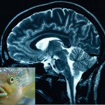 Brain and Fish oil